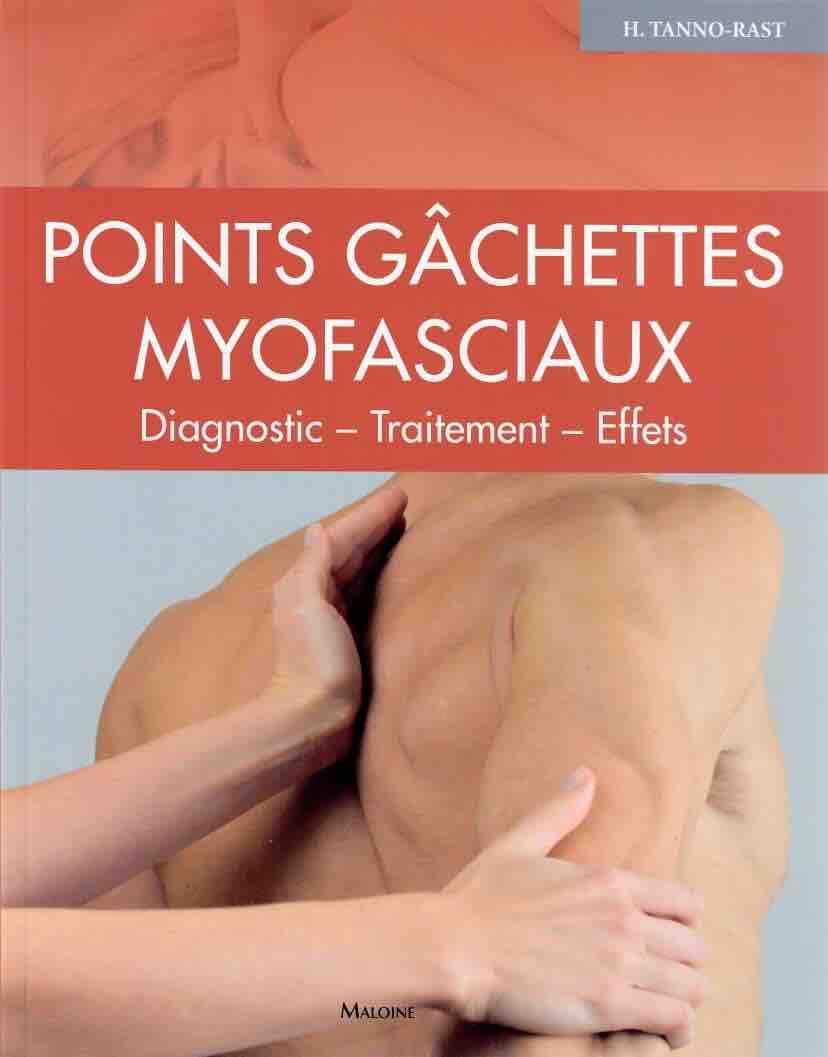 Points gâchettes Myofasciaux: Diagnostic ? traitement ? effets