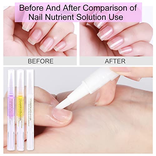Aceite para Cuticulas, Tratamientos para uñas, Aceite para Uñas, Aceite Reparador para Uñas y Cutículas, Pluma Lápiz para Cuidado de Uñas para Esmalte para Quitar Callos, 3 Piezas - imagen 4