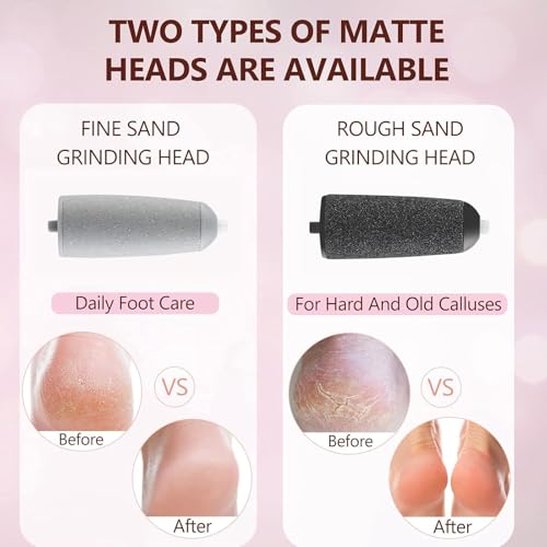 Hornhautentferner Elektrisch, Wiederaufladbarer Hornhaut Entfernen Fuß, Pediküre Set Fußpflege Elektrisch, Elektrischer Hornhautentferner für Fußpflege für Harte, Abgestorbene (Rosa)