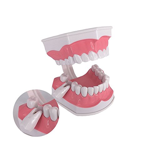 Large Dental Teeth Model,Youya Dental Teaching Study Brushing Tooth Model Tools With Toothbrush & Removable Lower Teeth For Kids Oral Care Teaching #TOP3
