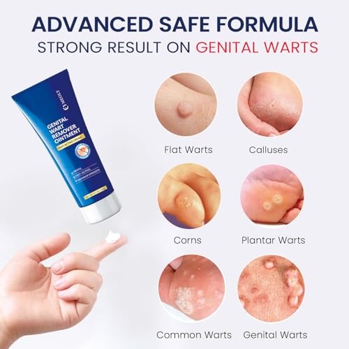 Image of MEOLY Genital Wart Remover Cream: Genital Wart Removal Ointment with Salicylic Acid Fast-Acting, Gentle for Men and Women