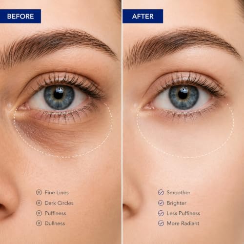 LROVFND Caviar + Hyaluronic Acid Eye Cream, Anti-Aging Moisturizing Treatment for Dark Circles, Puffiness, Fine Lines & Wrinkles, Lightweight & Fast-Absorbing, 0.7FL.OZ(20g) — view 3