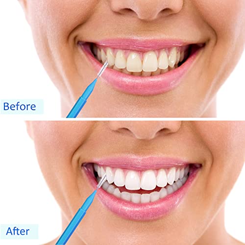 Image of Patelai 100 Pcs Braces Dental Brushes,Classic Color,Mixed Size