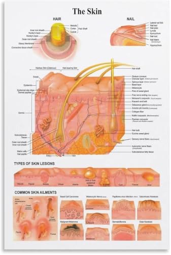 Poster types of skin affiche anatomique en toile encadrée 30x45cm pour cabinet