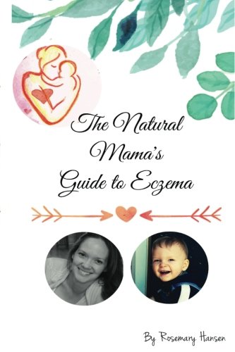 The Natural Mama's Guide To Eczema: Proven natural remedies for soft skin