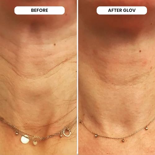 Glov Beauty Micro Infusion System for Face & Lips – 0.25mm 24k Gold Cosmetic Facial Stamp with Hyaluronic Acid, Collagen Peptides & Licorice Root Serum Ampoules (4x Infusion Application, 12x Serums) 5ml