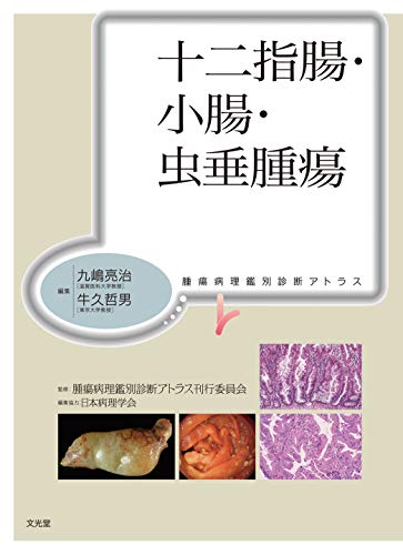 十二指腸・小腸・虫垂腫瘍 (腫瘍病理鑑別診断アトラス)