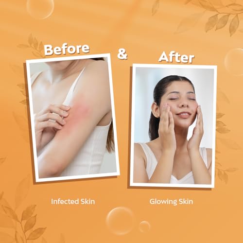 Image of Antiseptic Bathing Bar Soap Combo Pack of 5 (75g Each)- for Complete Protection Against Skin Infection & Germs|Added Glycerin for Hydrate Skin|Makes Soft & Healthy Skin(Unisex)