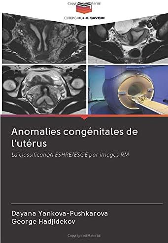 Anomalies congénitales de l'utérus: La classification ESHRE/ESGE par images RM