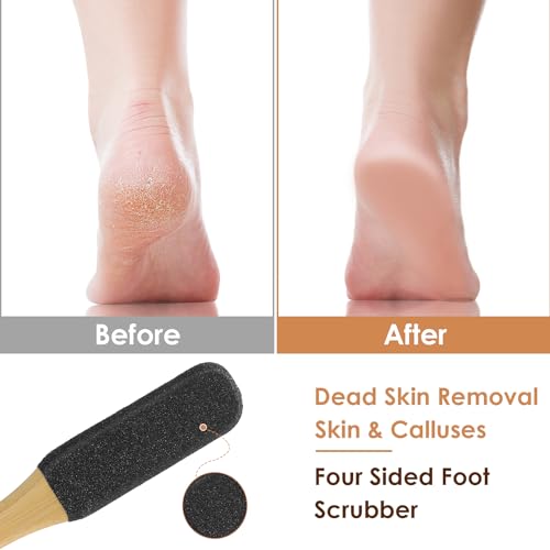 Gjinxi 577375_1_SKP95D3U Pumice Stone Foot File, Foot Callus Remover With Wooden Handle Double-Sided Foot Rasp thumb #2