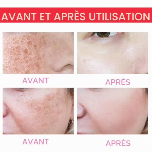 Pemarlis 2PCS Faded Topicals Serum, Serum Eclaircissant Faded Topicals Serum, Topicals Faded Serum Visage, Réduit la décoloration, les marques post-clémiques, les cicatrices et les – vue 4