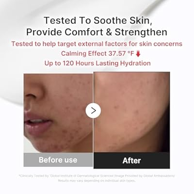 medicube 3H Daily Relief Cream | Daily Soothing Moisturizer for All Skin Types | Lightweight Comforting Cream Ideal For Use After Spot Care | Guaiazulene, Centella, Ceramide for Balance and Hydration
