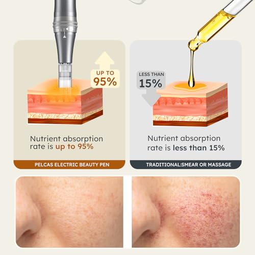 PELCAS Dermapen mit 9 Geschwindigkeitsstufen Mikronadelgerät einstellbare Länge Elektrisch Microneedling Pen Schönheit Pen mit 12 Patronen Wiederaufladbar Kabellos Mikronadel Stift