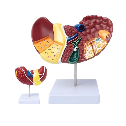 Human Anatomy Liver Model, Life Size Anatomy Liver Model,with Clear Texture and Pathological Features and 2 Detachable Partsl for Teaching Demonstration and Explanation