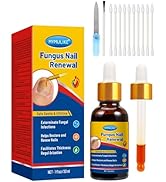 MYMULIKE Nail Repair, Nail Renewal Liquid, Extra Strength Nail Solution for Damaged and Discolour...