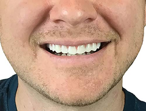 Instant Smile 12206 Comfort Fit Flex - Natural Shade - Upper Veneer Cosmetic Teeth thumb #1