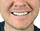 Instant Smile Comfort Fit Flex Kosmetische Zähne, Natural Shade, Comfortable Upper Veneer, One Size Fits Most, Perfect for Daily Use