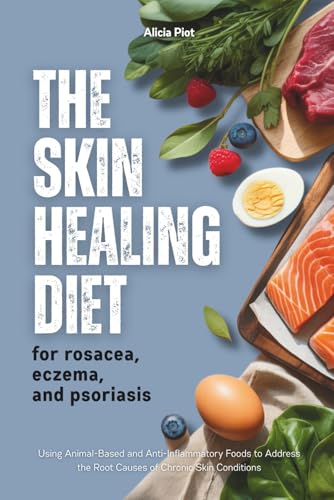 The Skin Healing Diet For Rosacea, Eczema And Psoriasis