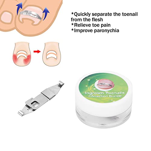 Ingrown Toenail Treatment, Ingrown Toenail Corrector, Ingrown Toenail Tools - Image 4