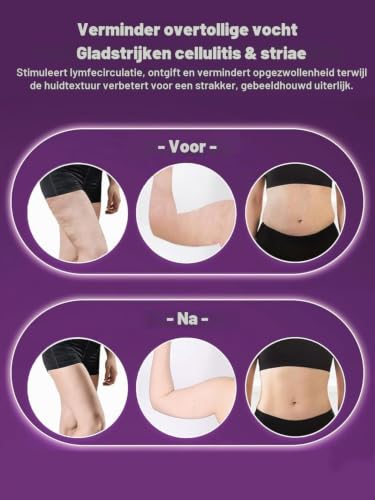 Beautique BodySculpt 5-in-1 – Cellulitis & Lymfedrainage - View 2