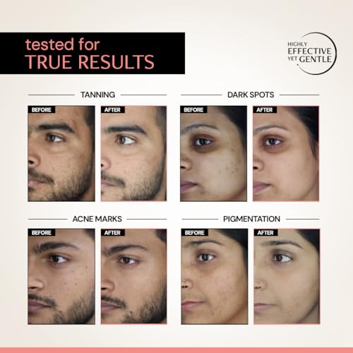 Image of Deconstruct 5% Niacinamide Serum + 2% Alpha Arbutin Clearing Serum| Clinically Tested| Reduces Dark Spots, Pigmentation, Acne Marks & Tanning |4-in-1 Multi-Benefit |Non-Irritating | 10ml