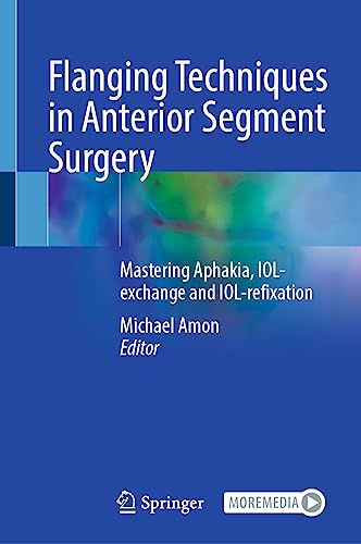 Flanging Techniques in Anterior Segment Surgery: Mastering Aphakia, IOL-exchange and IOL-refixation