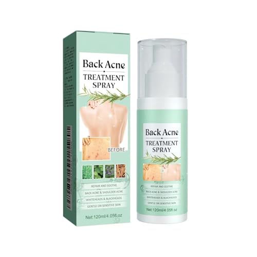 Spray para el cuidado de la espalda mejora la apariencia de las manchas, calma la espalda, limpia el cuerpo y alisa la piel, 120 ml HzN801 (verde menta, 120 ml)