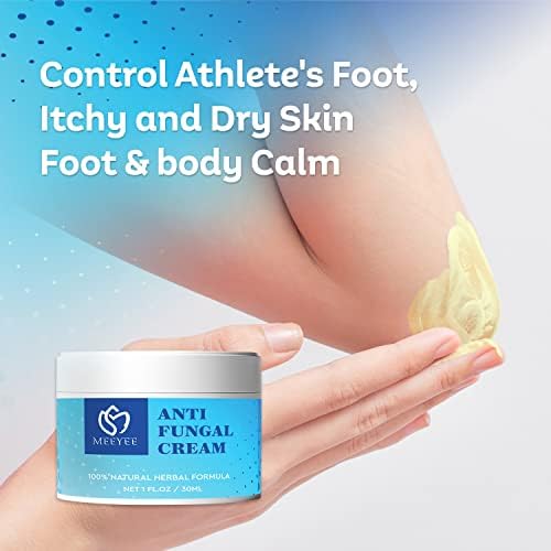 Antifungal Cream, Anti Fungal Skin Cream Helps Eczema, Ringworm, Jock Itch, Athletes Foot, Anti-Itch Balm for Face & Body, Gentler and Safer