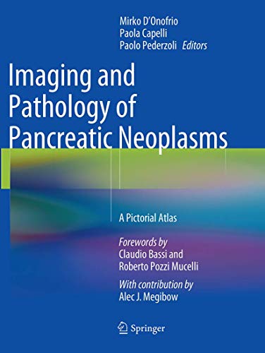 Imaging and Pathology of Pancreatic Neoplasms: A Pictorial Atlas