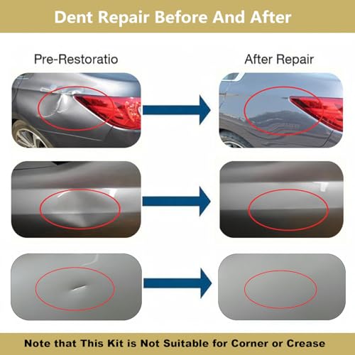 Image of Paintless Dent Repair Kit, Double Pole Bridge Dent Puller with 8 Bridge Tabs,