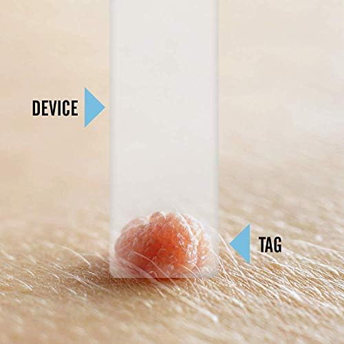 Tagcure PLUS Skin Tag Removal Kit For Easy Skin Tag Removal - Includes x10 Tag Bands x10 Cleaning Swabs & x10 Plasters To Cover Tag Area (For Tags Between 0.5cm - 0.7cm)