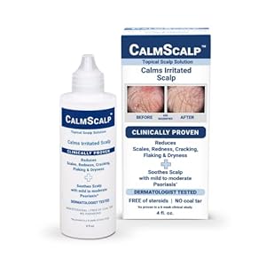 Topical Solution for Symptoms of Mild to Moderate Psoriasis | Irritated Scalp | Hairline Scales | Redness | Dry Scalp | Made in The USA | 4 oz.