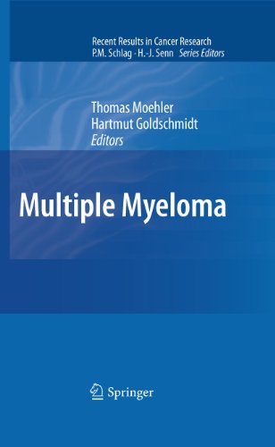 Multiple Myeloma view 2