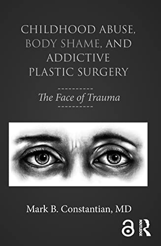 Childhood Abuse, Body Shame, and Addictive Plastic Surgery: The Face of Trauma - //medicalbooks.filipinodoctors.org