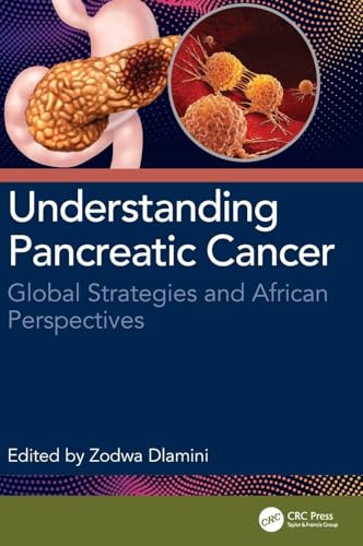 Understanding Pancreatic Cancer: Global Strategies and African Perspectives