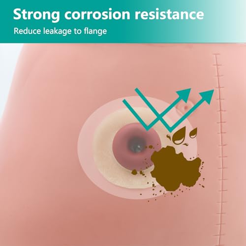image for Vlookup Ostomy Barrier Rings - Outer Diameter 2