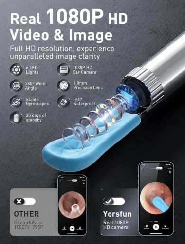 Image of Ear Wax Removal - 3 in 1 Wireless WiFi Rechargeable Ear Cleaner, 1080P HD Camera Lens & 7 Pcs Ear Set, Ear Cleaning Kit with 15 Replacement Tips, Black