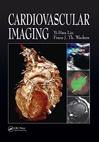 Cardiovascular Imaging view 2