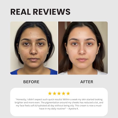 Image of Wise & Secrets B+ Face Brightening Cream 25gm for Dark Spots & Pigmentation | Kojic Acid, Niacinamide & Alpha Arbutin | Melasma & Acne Marks Remover Skin Tone Corrector & Glow Cream | For Men & Women