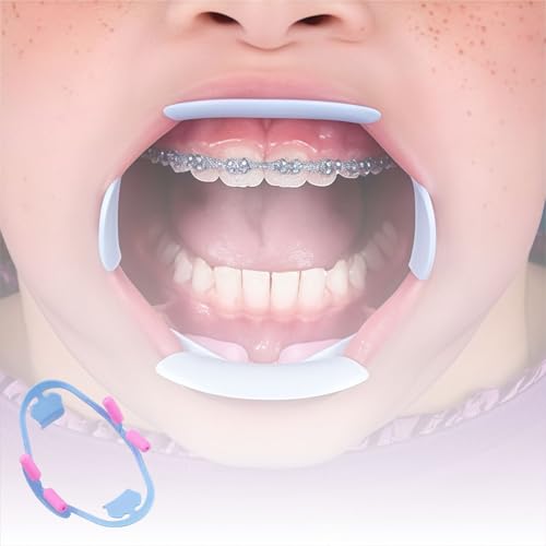 Dental 3D Cheek Retractor für Intraoralzahn Oral Spreader, Mund Props Opener für Zahnarzt Hilfe Zubehör, 2 Pcs (L)