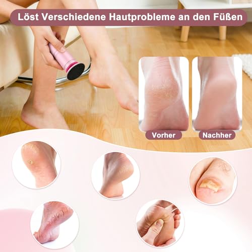 zeigt effektive Hornhautreduktion ohne Hautirritationen dank 3600 U/min Drehzahl und IPX5-Schutz. (119 Zeichen)