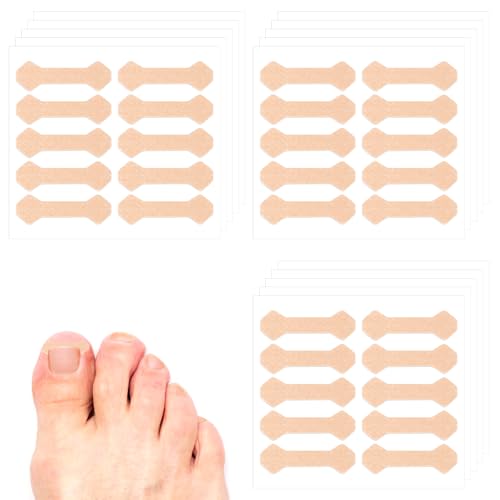 150 peças de tiras encravadas para unhas dos pés, corretor de unhas encravadas respiráveis, ferramen