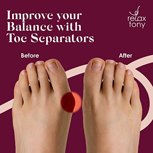 Anatomical Toe Seperators, Straighteners & Spacers For Fitness and Wellness Use Correct Your Toes Na