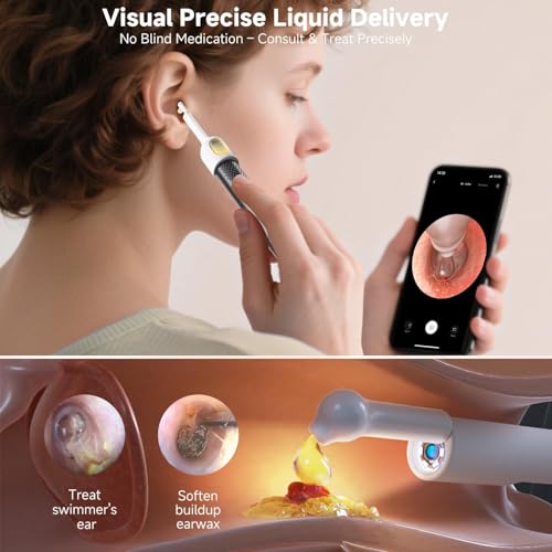 BEBIRD R1 Ultra Ear Wax Removal, Ear Cleaner with Camera Ear Scope, Wax Remove Ear Pick with Ear Otoscope Tweezers, Visual Dropper Cleaning Kit, Ear/Nose/Throat Examination Tool for Family - Image 7