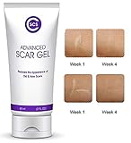 CSCS Most Effective Scar Remover Cream with Hydrolyzed Collagen & Vitamin E - Heals Old & New Scars from Cuts, Acne, Stretch Marks, Burns & Post Surgeries Scars - Fast Results, for All Skin Types 2 oz