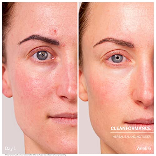 DOCTOR BABOR Cleanformance Gesichtstoner gegen fettige und glänzende Haut, Mit Mastix und Niacinamid, Aromatischer… - Image 4