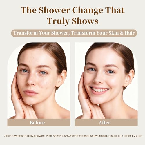 Image of BRIGHT SHOWERS Filtered Shower Head, High Pressure Fixed Showerhead for Hard Water, Dual-Media Filter Removes Chlorine & Impurities, 8 Spray Modes, Oil Rubbed Bronze