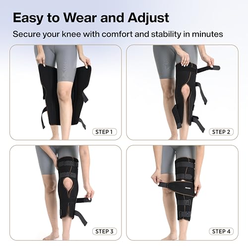Image of FOVERA Knee Immobilizer Brace for Knee Support - Stabilizer Splint for Dislocation, Ligament Tear, & Injury Recovery with Wraparound Design & 5 Adjustable Straps for Men & Women (M)