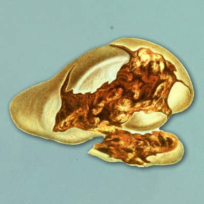 The Student Who Ate 5-Day Old Pasta And His Liver Shut Down Podcast Por  arte de portada