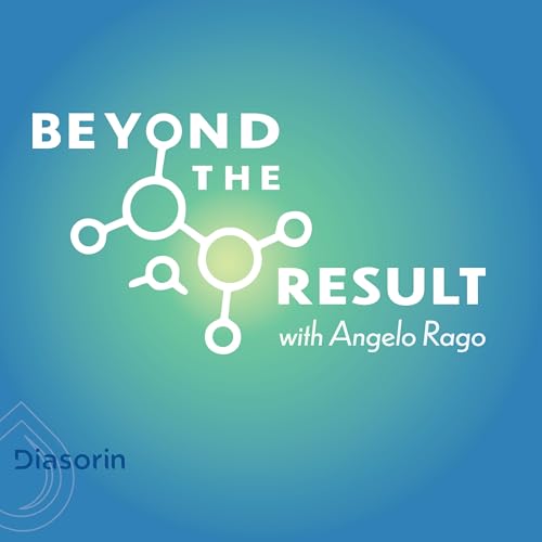 『Beyond The Result』のカバーアート